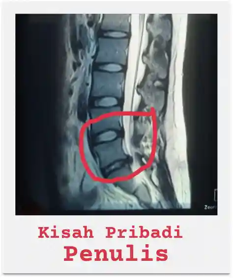 Hasil Scan MRI Saraf Kejepit